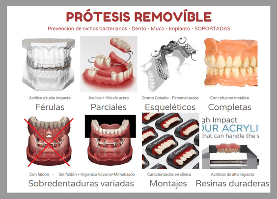 Laboratorio Dental Miguel Eizaguirre prótesis removibles 1