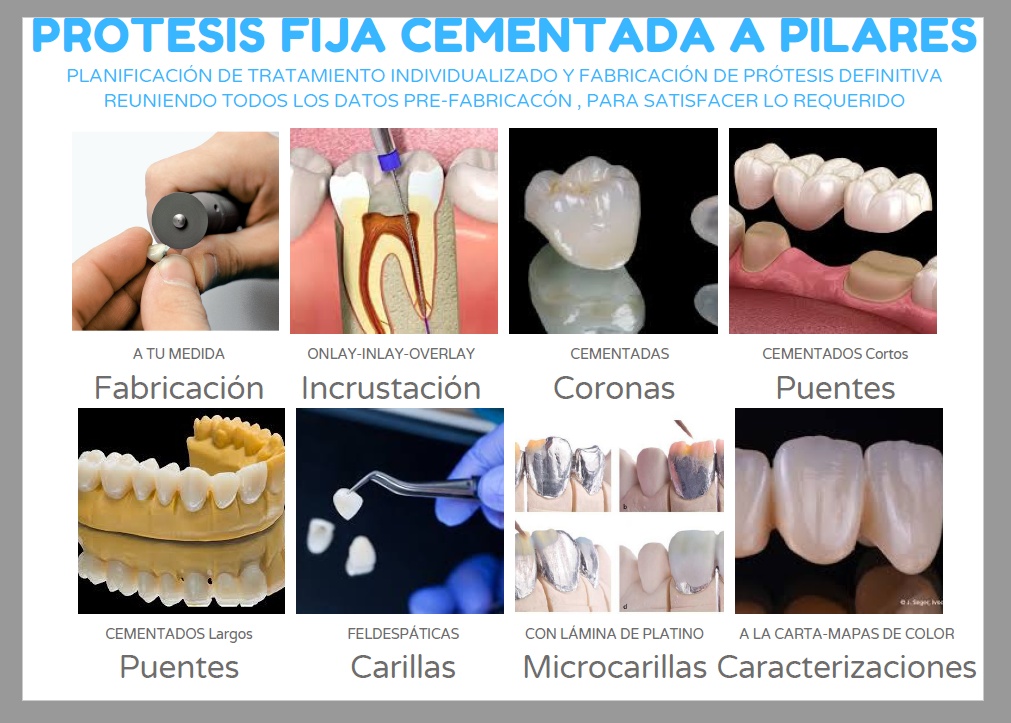 Laboratorio Dental Miguel Eizaguirre fija 1