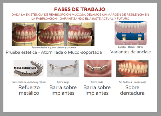 Laboratorio Dental Miguel Eizaguirre prótesis removibles 2